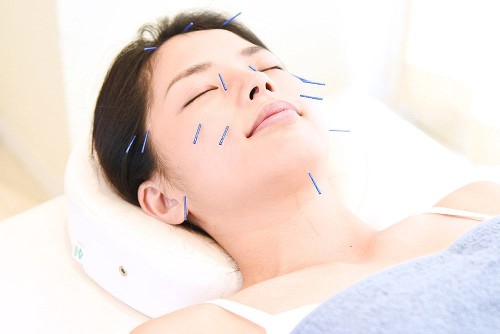 正社員 鍼灸師 接骨院・整骨院 鍼灸整骨院求人イメージ