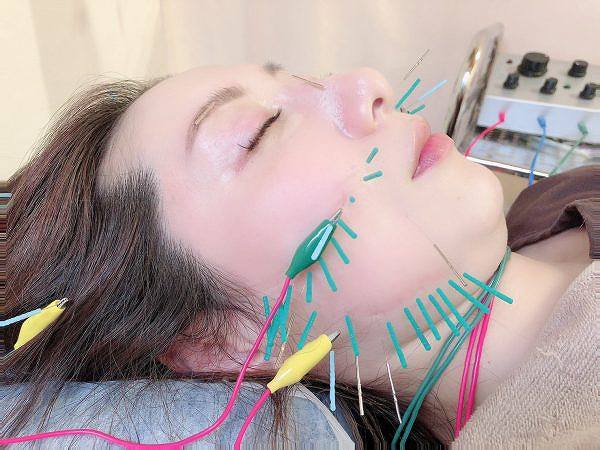 オリンピア鍼灸整骨院の正社員 柔道整復師 接骨院・整骨院の求人情報イメージ3