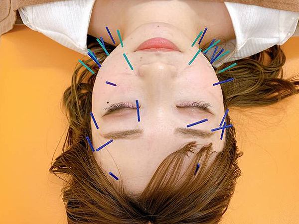 i-careの正社員 鍼灸師 接骨院・整骨院 鍼灸整骨院求人イメージ