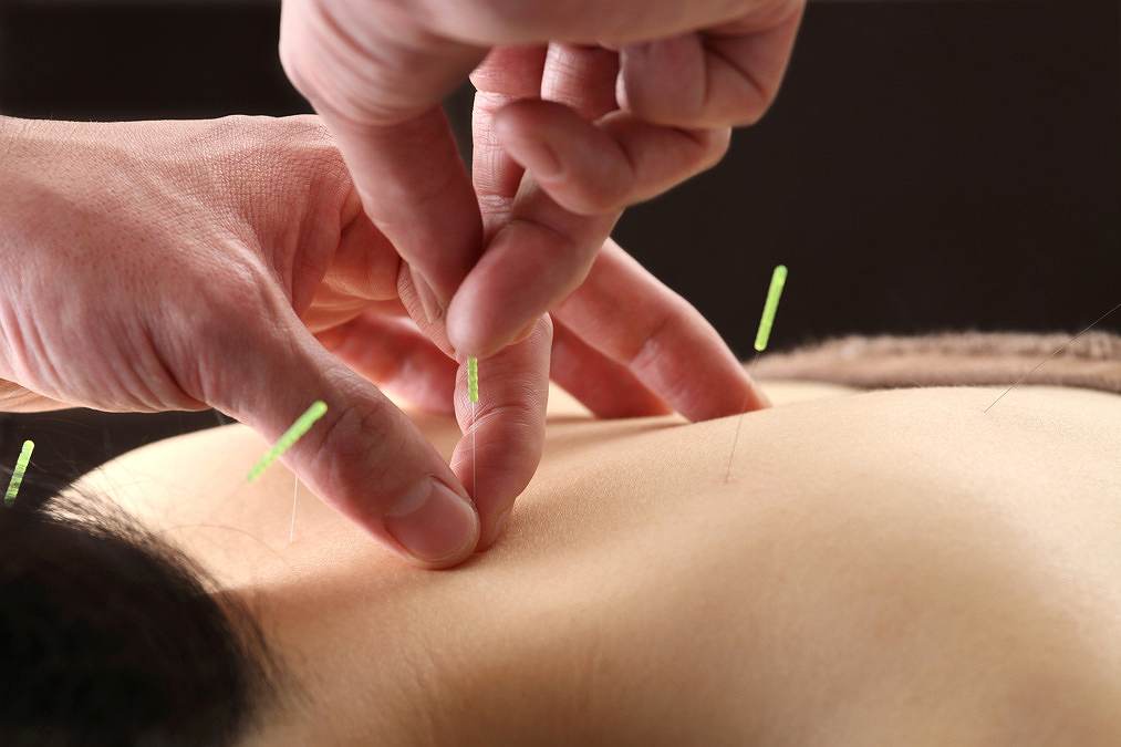 プロフェッショナルメディックの正社員 鍼灸師 接骨院・整骨院 鍼灸整骨院の求人情報イメージ3