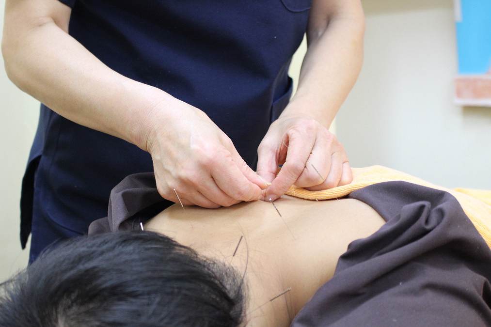 正社員 鍼灸師 接骨院・整骨院 鍼灸整骨院 鍼灸院・鍼灸サロンの求人情報イメージ3