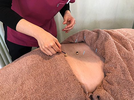 正社員 鍼灸師 接骨院・整骨院 鍼灸整骨院求人イメージ